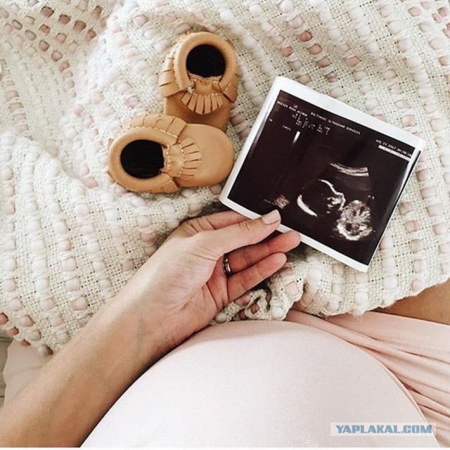 В Благовещенске женщинам, которые хотят сделать аборт, будут выдавать детские пинетки