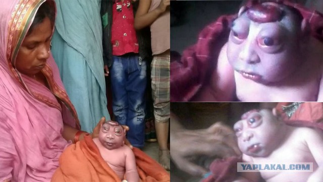 В Индии женщина родила мальчика, которого считают воплощением бога Ханумана