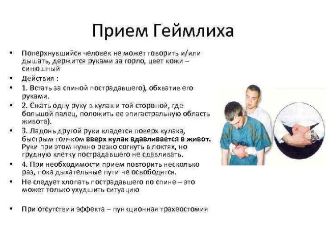 Сердечно-лёгочная реанимация (СЛР). Лекция 2 - презентация онлайн