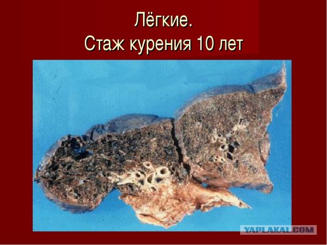 Что такое снюс? Про новую, опасную зависимость подростков