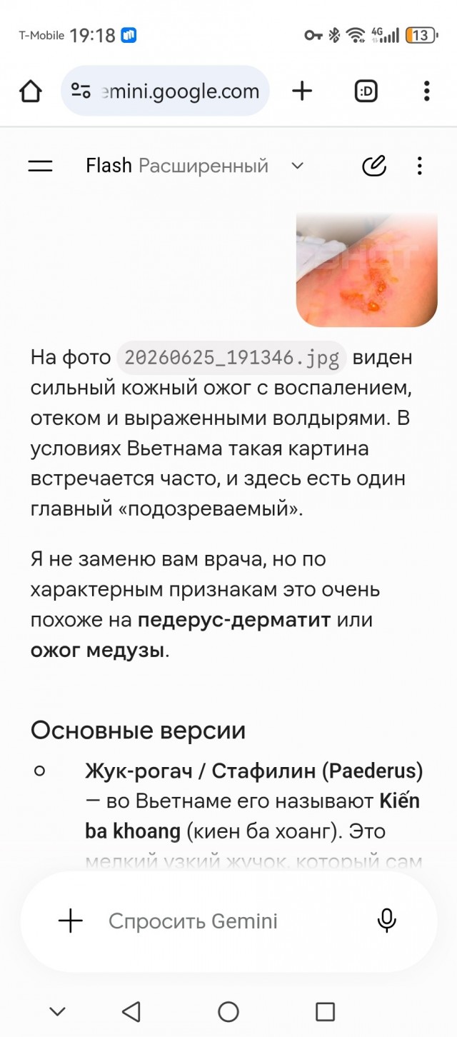 ChatGPT едва не убил россиянку, перепутав укус ядовитого томката и медузы