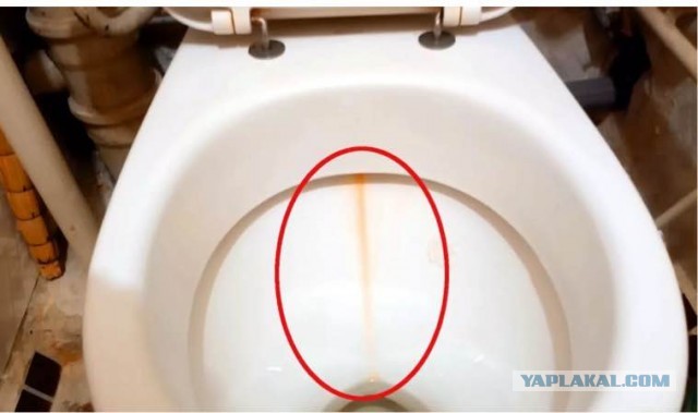 Бачок унитаза