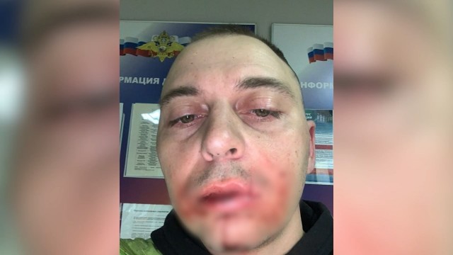 Петербуржца избили при детях за просьбу выгуливать бойцовскую собаку в наморднике