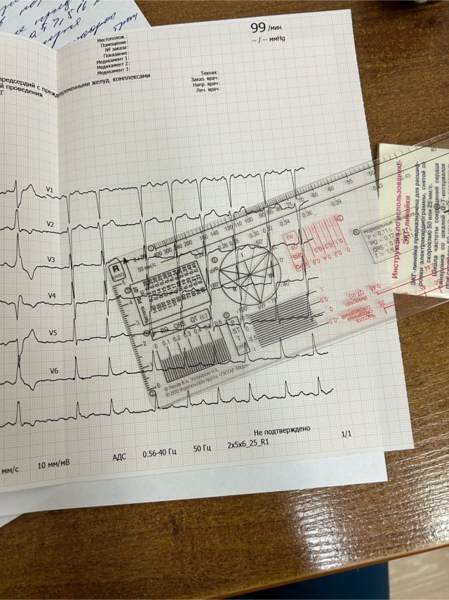 Хочешь узнать, как женщина занимается сексом? Посмотри на то, как она ест