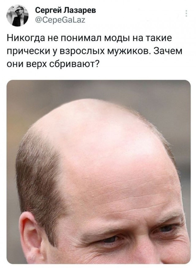 День лысых мужчин отмечается сегодня