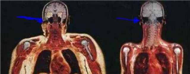 Скан женщины 113 кг и 56 кг