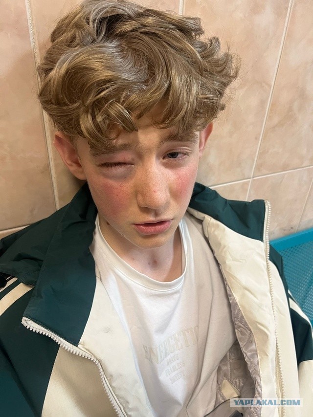 В Петербургской школе произошли кровавые разборки, скорее всего виновнику за это ничего не будет.