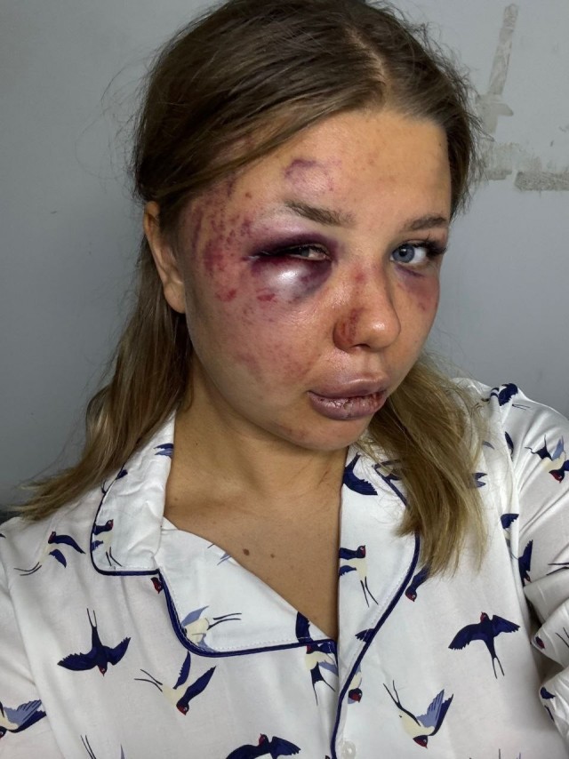 В Твери задержан боец ММА из Дагестана по подозрению в жестоком избиении своей сожительницы
