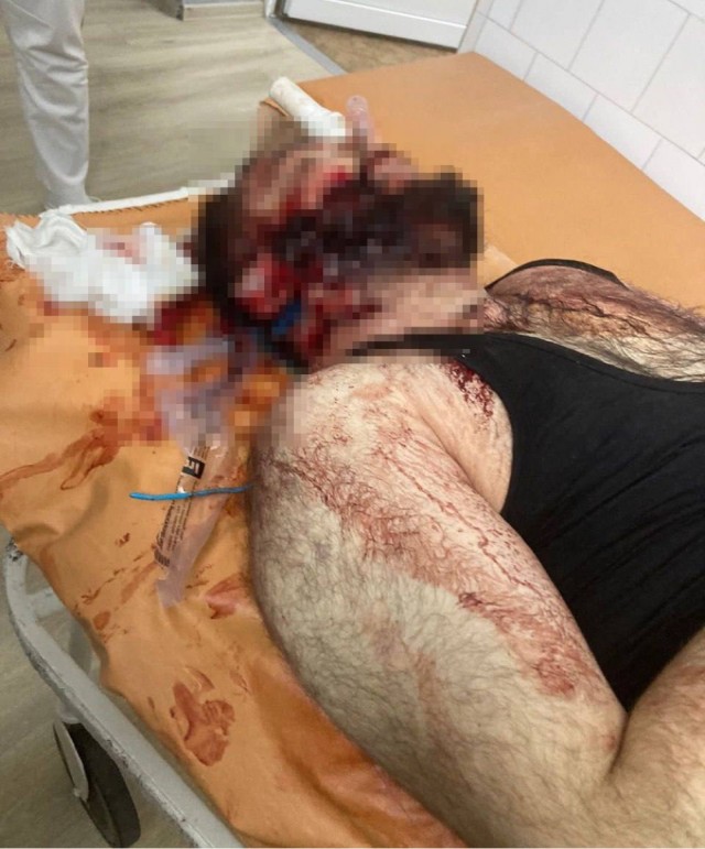 В Ставрополе неизвестные расстреляли мужчину у итальянского ресторана