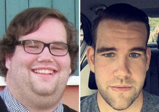 Как меняется лицо и его выражение после сильного похудения