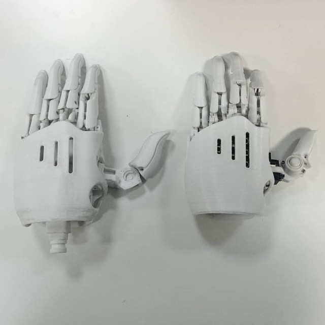Якутяне сделали бионический протез руки, распечатанный на 3D-принтере