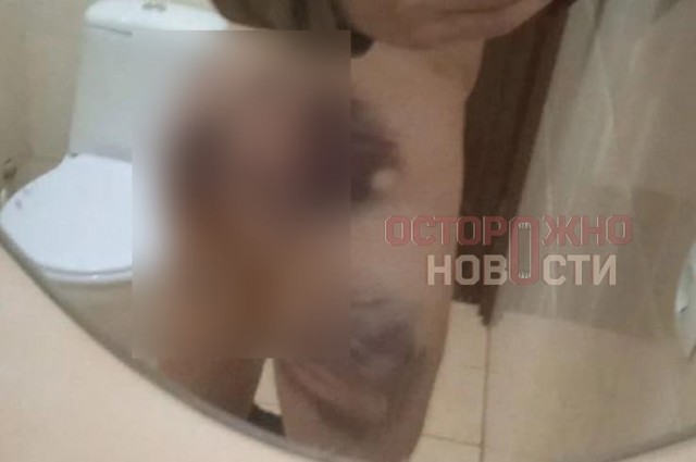 «Надели наручники и привязали к турнику. Голову обмотали скотчем, в рот засунули шапку и дубинками отбивали мышцы»