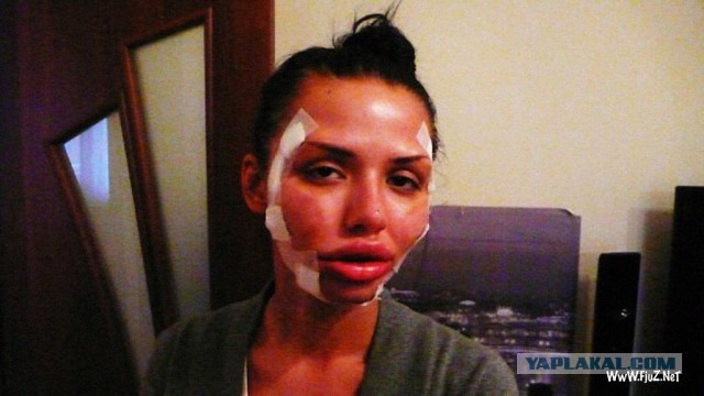 Знаменитости, которые безобразно стареют