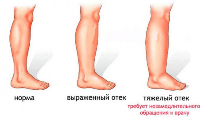 Пандемия. Коронавирус и съехавшие крыши. Россия и мир. Часть 31.