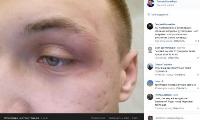 Запись программы "Право голоса" на "ТВ Центре" закончилась потасовкой