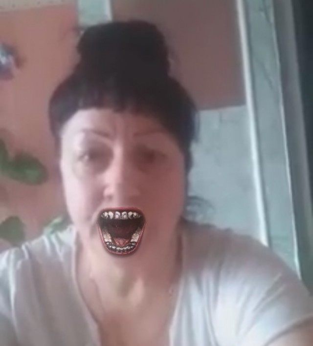 Виниры для Венеры...