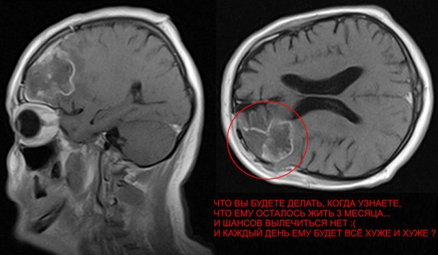 Как я умирал