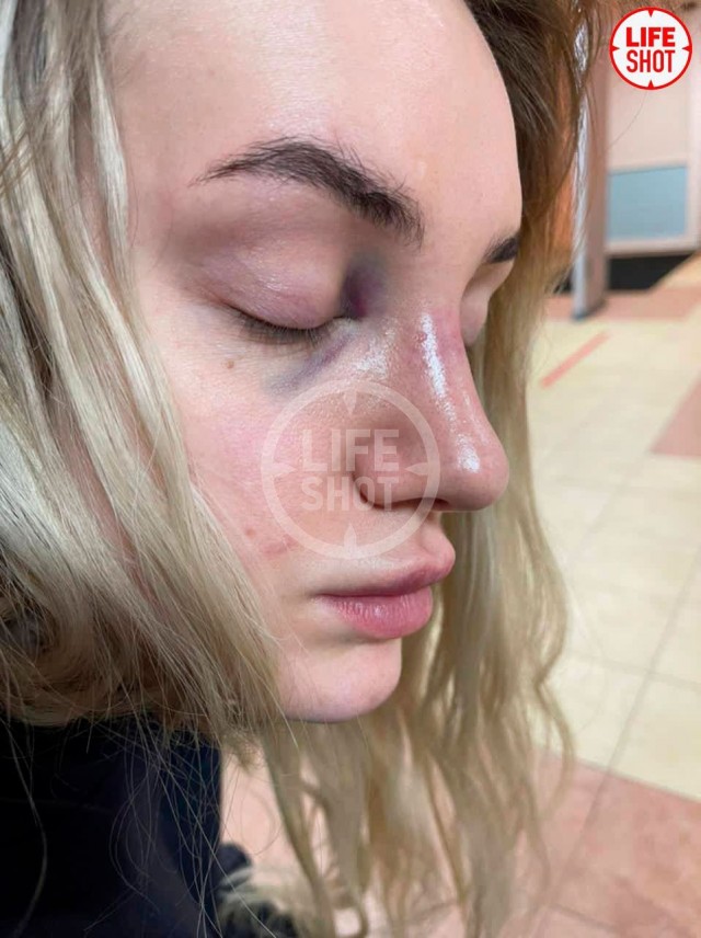 Москвичка обвинила своего молодого человека в жестоком избиении. Она называет его "сотрудником ГРУ".