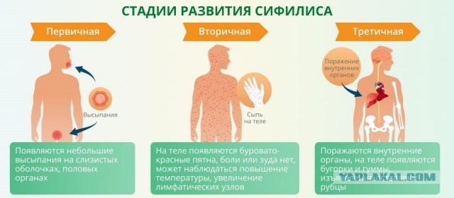 Сифилис у 3х летнего ребенка из-за бабушки