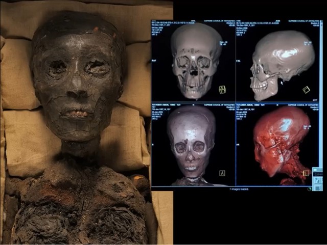 Медицина в Древнем Египте - часть 6