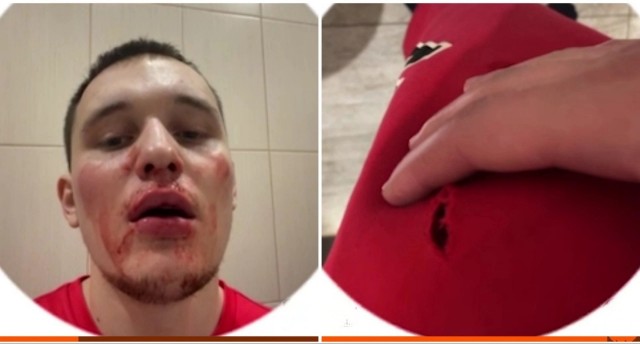 В Екатеринбурге 21-летний спортсмен вступился за девушку, которую силой тащила компания парней