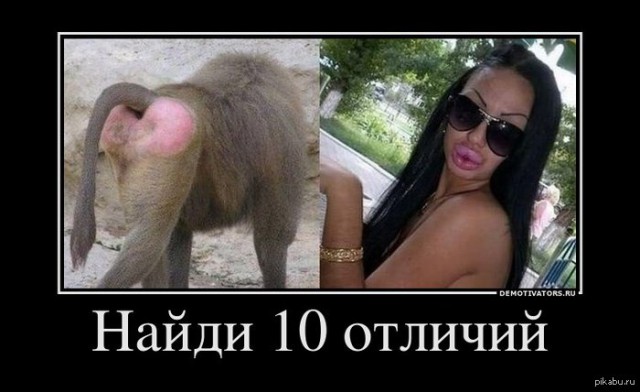 Трудовые мозоли