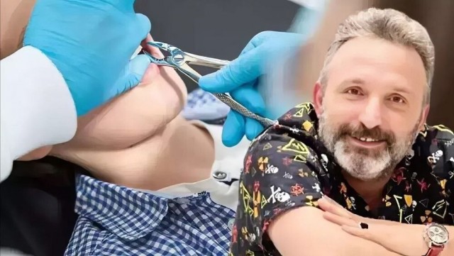 В Турции уборщик выдал себя за стоматолога и удалил пациенту зубы