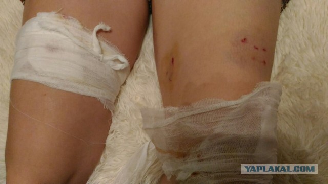 В Новочебоксарске кошка до крови искусала девушку и преследовала ее до квартиры