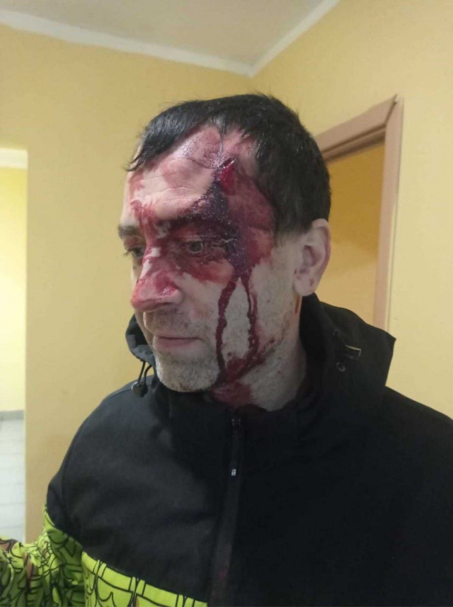 В Московской области абу-бандит палкой разбил местному жителю голову.