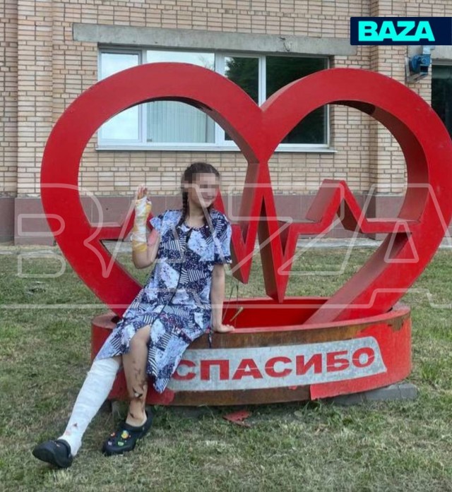 Девушка плеснула в мангал самогон вместо воды и вспыхнула на глазах у жениха — так закончилась годовщина их отношений