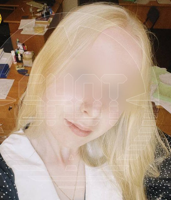 В Питере девушка попала в реанимацию с 80% ожогами тела после того, как позагорала на солнце