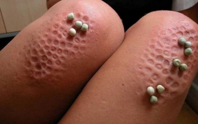 Ставившего четырёхлетнюю падчерицу на горох россиянина осудили на 5 лет колонии строгого режима