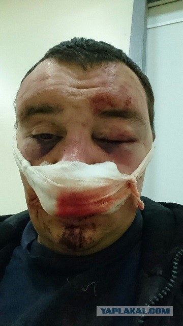 Заместитель председателя правления банка жестоко избил своего соседа в Москве