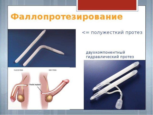 Победная поступь идиотизма по планете – том 13