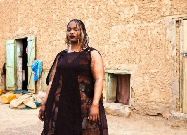 17 печальных фактов об ожирении, от которых многим срочно захочется похудеть