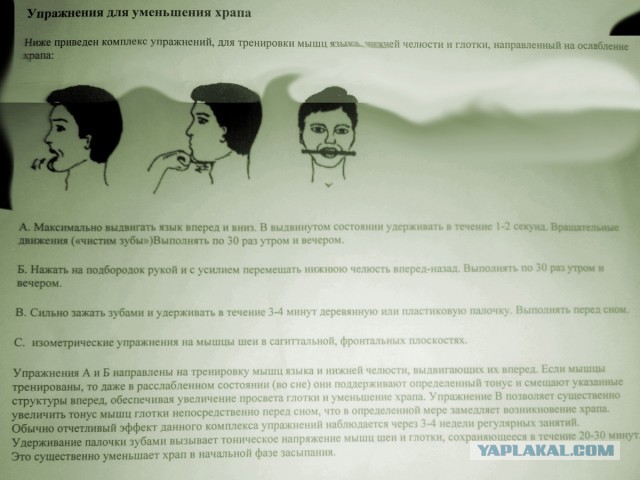 Сонное апное! Или как после многих лет нашёл свою проблему