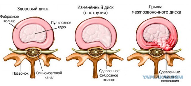 Поясница и прочее