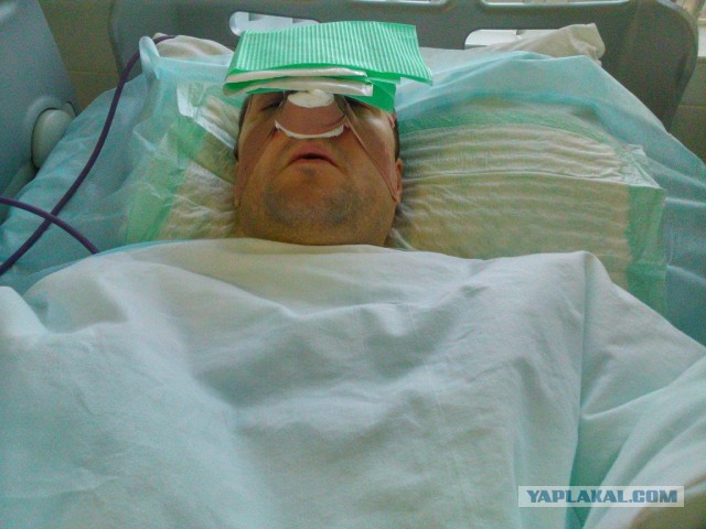 Заступился за жену и был за это жестоко избит