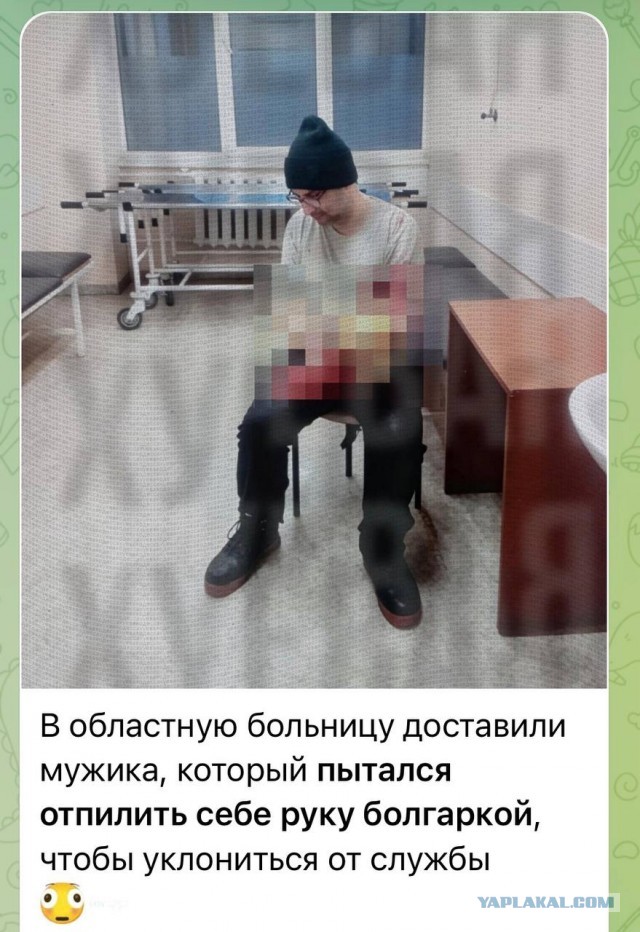 Кардинальный способ отмазаться от армии.