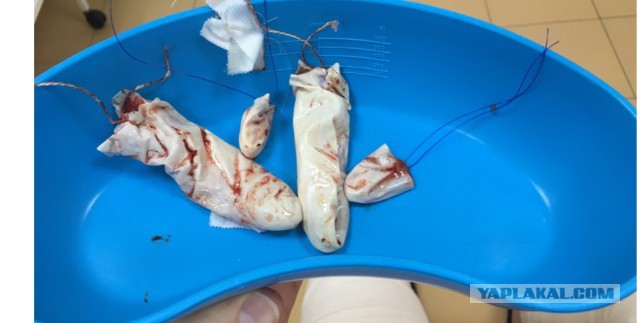Про бесплатную медицину и … мой орган из трёх букв