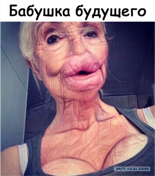 Как выглядит Маша Малиновская после новой пластики