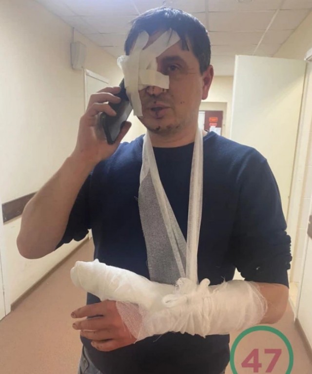 В полицейского стреляли в упор, а он выжил и скрутил