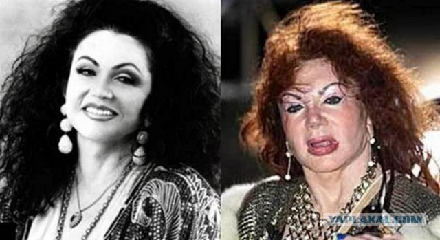 Знаменитости, которые безобразно стареют