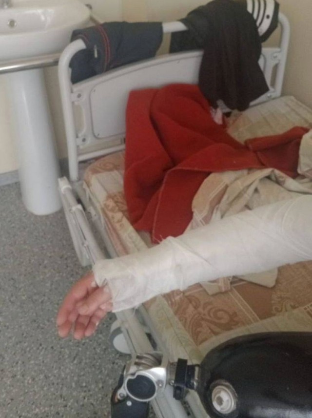 Ветерана СВО без ноги жестоко избили за слишком громкий звук протеза