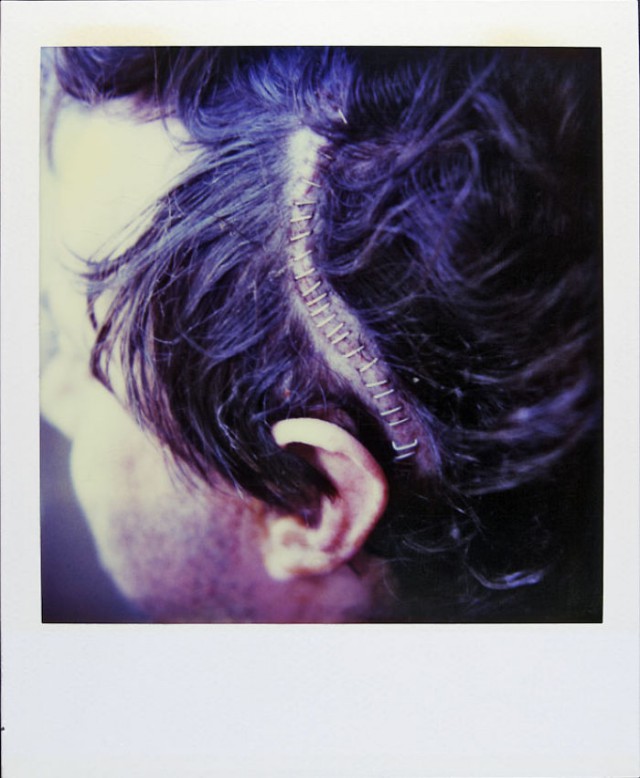 История мужчины, который снимал каждый день на Polaroid 18 лет, пока рак не украл его жизнь
