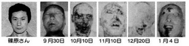 83 дня ада – история Оути Хисаси, «самого радиоактивного человека на Земле»