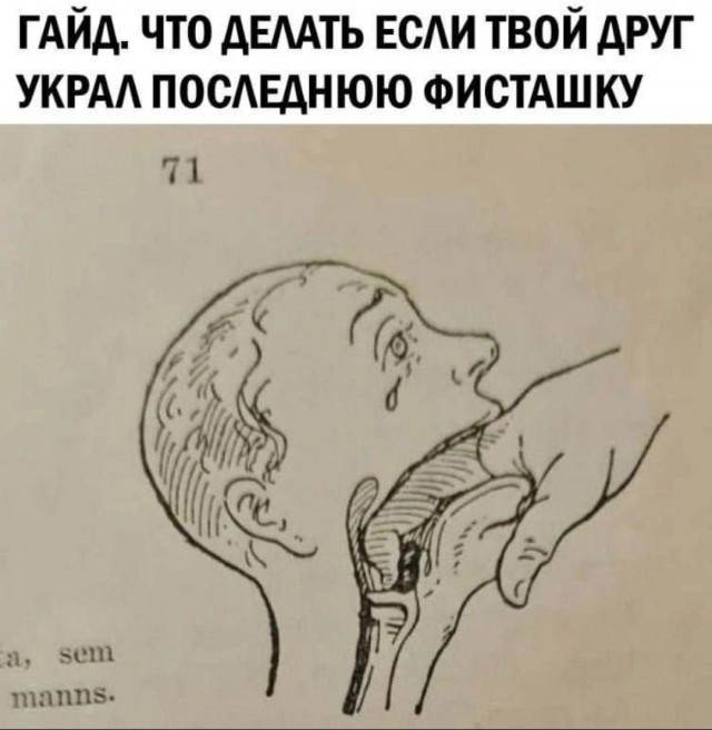 Прием Геймлиха применяли когда-либо?