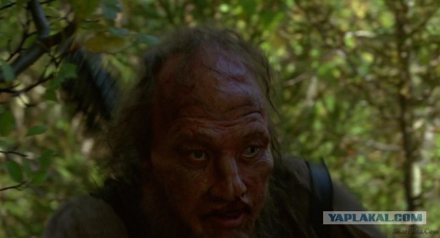 Эффект «заячьих губок»: результатами новой авторской методики поделилась косметолог-уродолог в сети