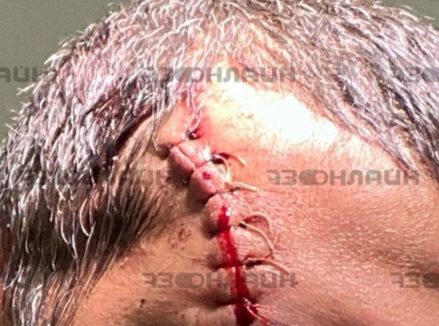 «Сапля» против полицейских. Бастрыкин взял дело под свой контроль.