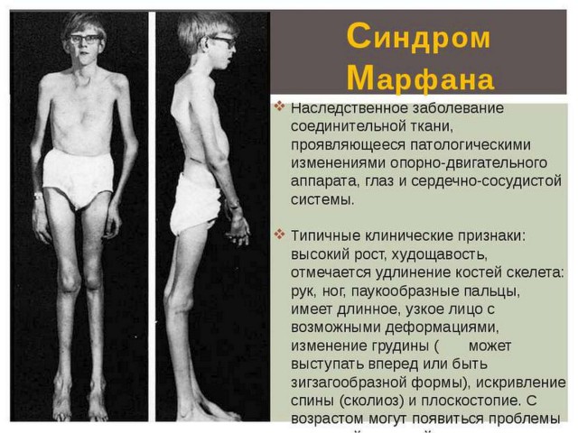 Где взять тапок для такой жути?